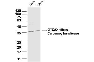 Lane 1: mouse iver lysates Lane 2: rat liver lysates probed with OTC/Ornithine Carbamoyltransferase Polyclonal Antibody, Unconjugated  at 1:300 dilution and 4˚C overnight incubation. (OTC 抗体  (AA 31-130))
