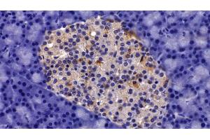 Detection of AST2 in Rat Pancreas Tissue using Polyclonal Antibody to Aspartate Aminotransferase 2 (AST2) (AST2 (AA 30-430) 抗体)