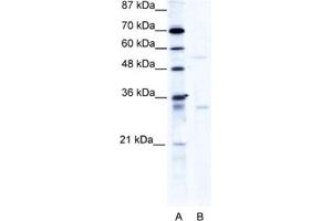 Western Blotting (WB) image for anti-TRIM17 / RNF16 (TRIM17) antibody (ABIN2460982) (TRIM17 / RNF16 抗体)