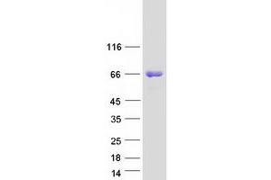 Western Blotting (WB) image for Epsin 2 (EPN2) (Transcript Variant 1) protein (Myc-DYKDDDDK Tag) (ABIN2720354)