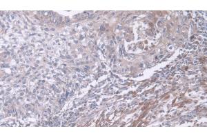 Immunohistochemistry (IHC) image for anti-Dual Specificity Phosphatase 6 (DUSP6) (AA 1-300) antibody (ABIN7436195)