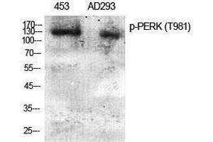 Western Blotting (WB) image for anti-Eukaryotic Translation Initiation Factor 2-alpha Kinase 3 (EIF2AK3) (pThr981) antibody (ABIN3179812) (PERK 抗体  (pThr981))