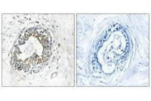 Immunohistochemistry analysis of paraffin-embedded human placenta tissue using PAK1/2 (Ab-199) antibody. (PAK1 抗体  (Ser199))