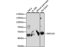 Western blot analysis of extracts of various cell lines, using RNF149 antibody (ABIN7270062) at 1:1000 dilution. (RNF149 抗体  (AA 221-400))
