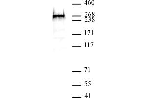 BAZ2A antibody (pAb) tested by Western blot. (BAZ2A 抗体  (N-Term))