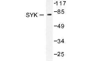 Image no. 1 for anti-Spleen tyrosine Kinase (SYK) antibody (ABIN271835) (SYK 抗体)