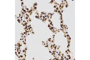Immunohistochemistry of paraffin-embedded rat lung using DiMethyl-Histone H3-K27 antibody. (Histone 3 抗体  (H3K27me))