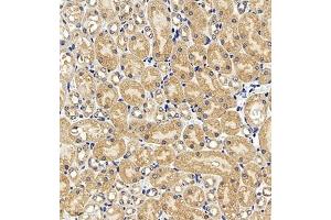 Immunohistochemistry of paraffin embedded mouse kidney using AZI2 (ABIN7072856) at dilution of 1:650 (300x lens) (AZI2 抗体)
