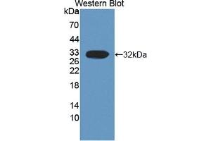Detection of Recombinant CAPN3, Human using Polyclonal Antibody to Calpain 3 (CAPN3) (Calpain 3 抗体  (AA 602-821))