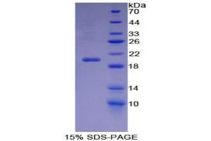 SDS-PAGE analysis of Mouse Carbonic Anhydrase VI Protein. (CA6 蛋白)