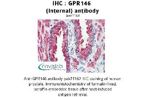 Image no. 2 for anti-G Protein-Coupled Receptor 146 (GPR146) (Internal Region) antibody (ABIN1734950) (GPR146 抗体  (Internal Region))