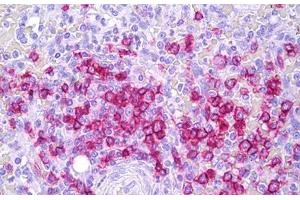 Anti-CD45RB antibody IHC staining of human spleen, lymphocytes. (CD45RB 抗体)