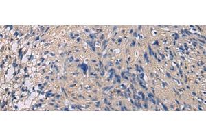 Immunohistochemistry of paraffin-embedded Human brain tissue using CHST3 Polyclonal Antibody at dilution of 1:35(x200) (CHST3 抗体)