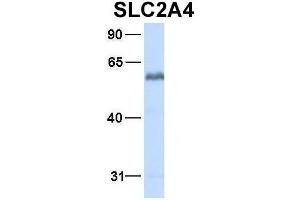 Western Blotting (WB) image for anti-Solute Carrier Family 2 (Facilitated Glucose Transporter), Member 4 (SLC2A4) (N-Term) antibody (ABIN2781558)