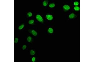 Immunofluorescence staining of Hela cells with ABIN7139603 at 1:12. (HIST1H1C 抗体  (meLys45))