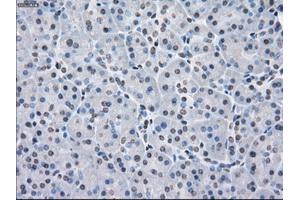 Immunohistochemical staining of paraffin-embedded Adenocarcinoma of colon tissue using anti-PPP5Cmouse monoclonal antibody. (PP5 抗体)