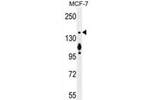 Western Blotting (WB) image for anti-Myosin VI (MYO6) antibody (ABIN5015885) (Myosin VI 抗体)