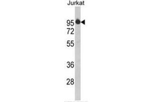 Western blot analysis of HTATSF1 Antibody (N-term) in Jurkat cell line lysates (35ug/lane). (HTATSF1 抗体  (N-Term))