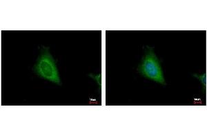 ICC/IF Image HSD17B4 antibody detects HSD17B4 protein at cytoplasm by immunofluorescent analysis. (HSD17B4 抗体  (N-Term))