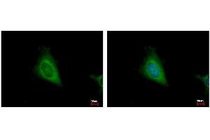 ICC/IF Image HSD17B4 antibody detects HSD17B4 protein at cytoplasm by immunofluorescent analysis. (HSD17B4 抗体  (N-Term))