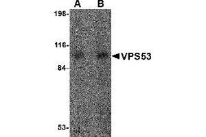 Western Blotting (WB) image for anti-Vacuolar Protein Sorting 53 Homolog (VPS53) (Middle Region) antibody (ABIN1031162) (VPS53 抗体  (Middle Region))