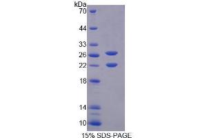 SDS-PAGE analysis of Mouse AVPI1 Protein. (AVPI1 蛋白)