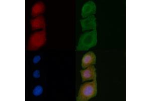 ABIN6257878 and ABIN6275516 staining Hela cells by IF/ICC. (SERGEF 抗体  (Internal Region))