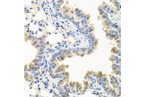 Immunohistochemistry of paraffin-embedded mouse lung using LRG1 antibody at dilution of 1:100 (40x lens). (LRG1 抗体)