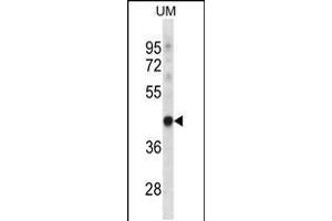 Western blot analysis in uterus tumor cell line lysates (35ug/lane). (TRUB1 抗体  (AA 152-180))