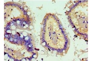 Immunohistochemistry of paraffin-embedded human small intestine tissue using ABIN7173812 at dilution of 1:100 (TNFSF18 抗体  (AA 72-199))