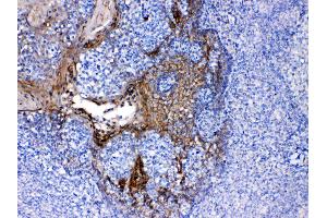 Immunohistochemistry (IHC) image for anti-Periplakin (PPL) (AA 1664-1701), (C-Term) antibody (ABIN5518787)