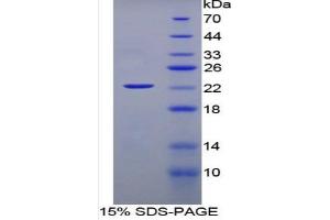 SDS-PAGE of Protein Standard from the Kit (Highly purified E. (IFNA ELISA 试剂盒)