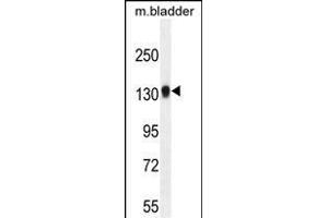 TDRD7 Antibody (C-term) (ABIN654935 and ABIN2844578) western blot analysis in mouse bladder tissue lysates (35 μg/lane). (TDRD7 抗体  (C-Term))