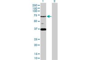 Western Blot analysis of RAD17 expression in transfected 293T cell line by RAD17 MaxPab polyclonal antibody. (RAD17 抗体  (AA 1-584))