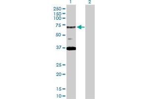 Western Blot analysis of RAD17 expression in transfected 293T cell line by RAD17 MaxPab polyclonal antibody. (RAD17 抗体  (AA 1-584))