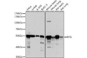 Western blot analysis of extracts of various cell lines, using BYSL antibody (ABIN6129546, ABIN6137672, ABIN6137674 and ABIN6215553) at 1:1000 dilution. (Bystin-Like 抗体  (AA 120-280))