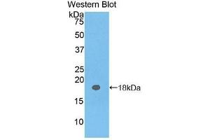 Western Blotting (WB) image for anti-Carcinoembryonic Antigen Gene Family (CEA) antibody (Biotin) (ABIN1172455)