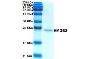 SDS-PAGE with Coomassie Blue Staining (HMGB2 蛋白)