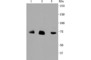 Lane 1: JAR lysates, Lane 2: HUVEC lysates, Lane 3: Hela lysates probed with Alas1 (1G11) Monoclonal Antibody  at 1:1000. (ALAS1 抗体)