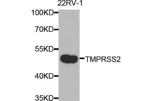 Western blot analysis of extracts of 22RV-1 cells, using TMPRSS2 antibody. (TMPRSS2 抗体)