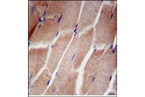 Immunohistochemistry analysis in Formalin Fixed, Paraffin Embedded Human skeletal muscle using RPL5 Antibody (N-term) followed by peroxidase conjugation of the secondary antibody and DAB staining. (RPL5 抗体  (N-Term))