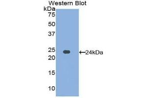 Western Blotting (WB) image for anti-Afamin (AFM) (AA 211-403) antibody (ABIN1857930) (Afamin 抗体  (AA 211-403))