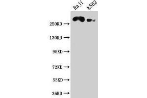 Western Blot Positive WB detected in: Raji whole cell lysate, K562 whole cell lysate All lanes: ATR antibody at 1:2000 Secondary Goat polyclonal to rabbit IgG at 1/50000 dilution Predicted band size: 302, 295, 298 kDa Observed band size: 302 kDa (ATR 抗体  (AA 2405-2644))