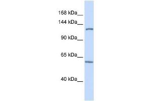 PHF12 antibody used at 0. (PHF12 抗体  (C-Term))
