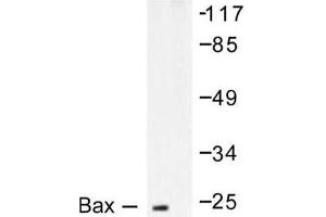 Image no. 2 for anti-BCL2-Associated X Protein (BAX) antibody (ABIN265325) (BAX 抗体)