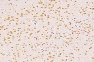 Immunohistochemistry analysis of paraffin-embedded rat tsubstantia nigra using SUN2 (ABIN7075502) at dilution of 1: 4000 (SUN2 抗体)