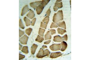 RVA Antibody (C-term) (ABIN653266 and ABIN2842784) IHC analysis in formalin fixed and raffin embedded human skeletal muscle tissue followed by peroxidase conjugation of the secondary antibody and DAB staining. (Parvin alpha 抗体  (C-Term))