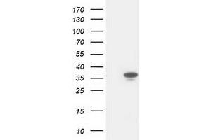Western Blotting (WB) image for anti-Cyclin-Dependent Kinase 2 (CDK2) antibody (ABIN1497397) (CDK2 抗体)