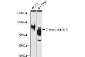 Western blot analysis of extracts of various cell lines, using Chromogranin A antibody (ABIN7266366) at 1:1000 dilution. (Chromogranin A 抗体)