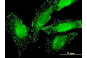 Immunofluorescence of monoclonal antibody to ELA2 on HeLa cell. (ELANE 抗体  (AA 168-267))